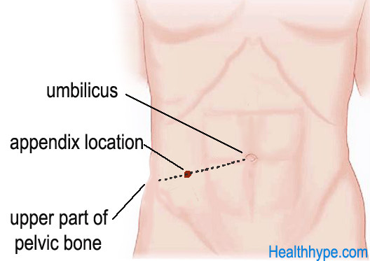 Description: Image result for appendicitis pain